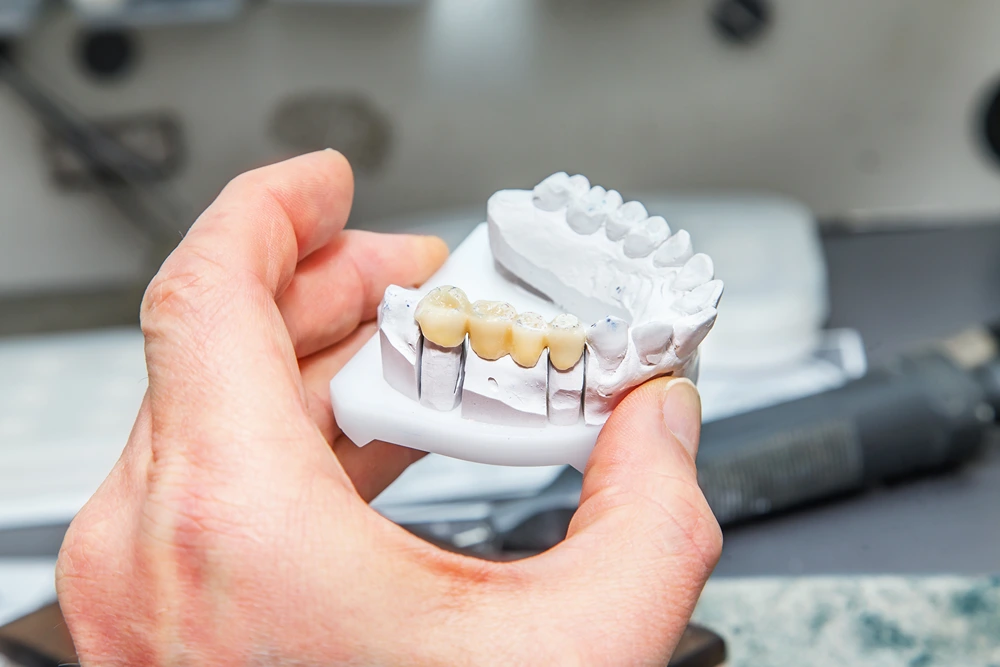 A hand holding a model of bottom teeth.